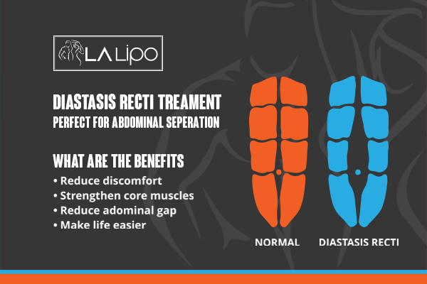 When Should You Consider Professional Help for Core Recovery Gosport