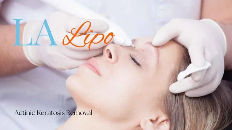 Woman receiving Actinic Keratosis Removal Treatment Gosport