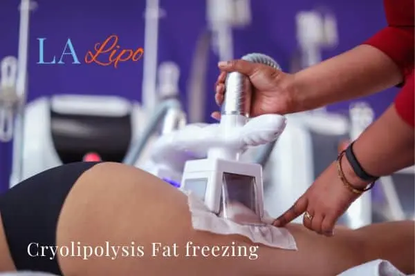 women getting fat freezing Gosport