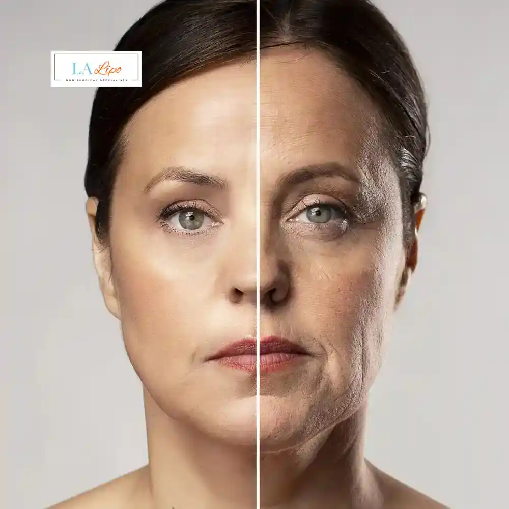 How Can You Tell If Non-Surgical Skin Tightening Is Right for You Gosport?
