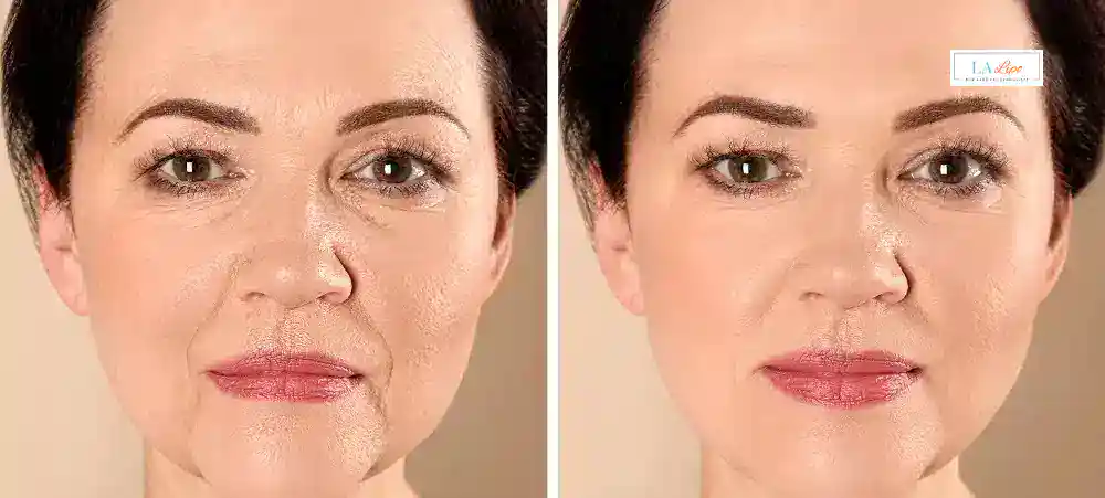 How Long Does It Take to See Results and How Long Do They Last Gosport?